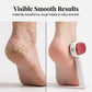 🦶 50% DE RÉDUCTION! ✨ Grattoir Pieds Double Face – Élimine les callosités, doux & facile à utiliser – Pieds lisses et adoucis en un clin d'œil 🏠
