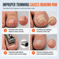 Coupe-ongles incarnés en acier inoxydable